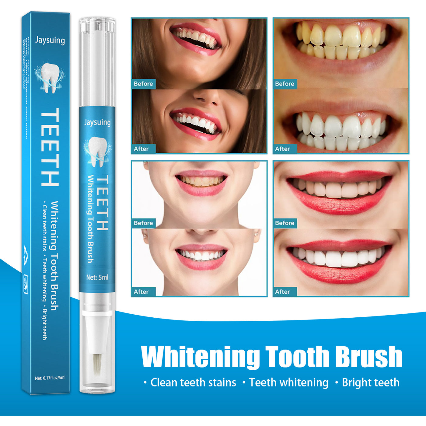 Jaysuing Teeth Whitening Plaque Cleaner Pen